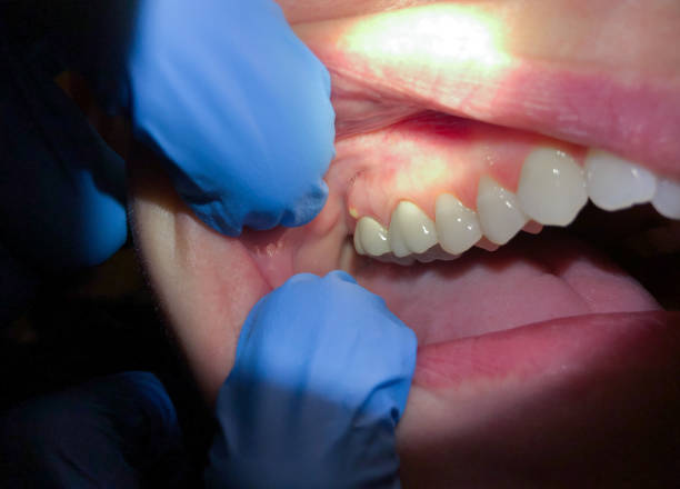 Best After-Hours Emergency Dentist in Cleveland, OK