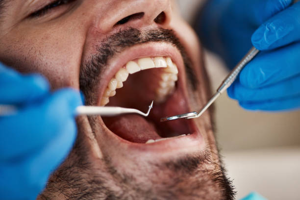 Best Emergency Tooth Extraction in Cleveland, OK